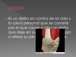  Es un delito en contra de la vida y
la salud personal que se comete
por el que cause a otro un daño
que deje en su cuerpo un vestigio
o altere su salud física o mental.
 
