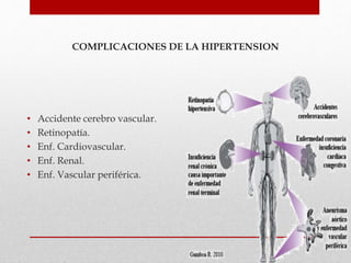 COMPLICACIONES DE LA HIPERTENSION
• Accidente cerebro vascular.
• Retinopatía.
• Enf. Cardiovascular.
• Enf. Renal.
• Enf. Vascular periférica.
 