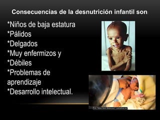 Consecuencias de la desnutrición infantil son:
*Niños de baja estatura
*Pálidos
*Delgados
*Muy enfermizos y
*Débiles
*Problemas de
aprendizaje
*Desarrollo intelectual.
 