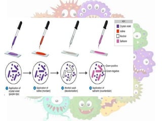 Exposicion de las bacterias
