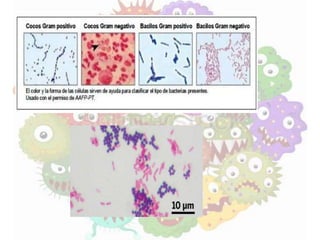 Exposicion de las bacterias