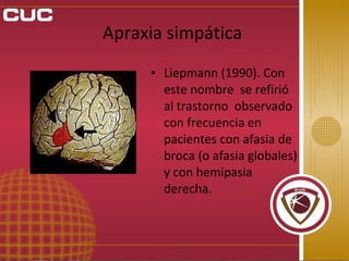 APRAXIA | PPT
