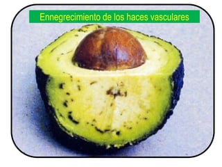Ennegrecimiento de los haces vasculares
 