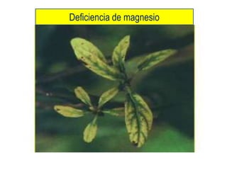 Deficiencia de magnesio
 