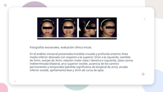 Fotografías extraorales, evaluación clínica inicial..
En el análisis intraoral presentaba mordida cruzada y profunda anterior, línea
media inferior desviada con respecto a la superior 2mm a la izquierda, overbite
de 5mm, overjet de 3mm, relación molar clase I derecha e izquierda, clase canina
indeterminada bilateral, arco superior ovoide, ausencia de los caninos
permanentes y temporales (pérdida significativa de longitud de arco), arcada
inferior ovoide, apiñamiento leve y 3mm de curva de spee.
 