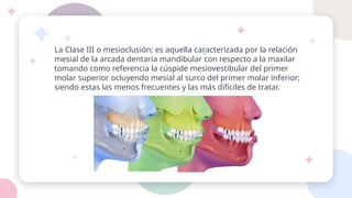 La Clase III o mesioclusión; es aquella caracterizada por la relación
mesial de la arcada dentaria mandibular con respecto a la maxilar
tomando como referencia la cúspide mesiovestibular del primer
molar superior ocluyendo mesial al surco del primer molar inferior;
siendo estas las menos frecuentes y las más difíciles de tratar.
 