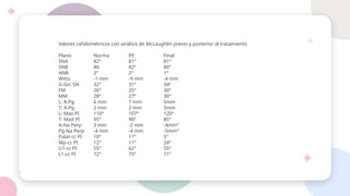 Valores cefalométricos con análisis de McLaughlin previo y posterior al tratamiento
Plano Norma PX Final
SNA 82° 81° 81°
SNB 80 82° 80°
ANB 2° 2° 1°
Witts -1 mm -9 mm -4 mm
G-Gn: SN 32° 31° 34°
FM 26° 25° 30°
MM 28° 27° 30°
L: A-Pg 6 mm 7 mm 5mm
T: A-Pg 2 mm 2 mm 3mm
L: Max PI 110° 107° 120°
T: Mad PI 95° 90° 85°
A-Na Perp 3 mm -2 mm -4mm°
Pg-Na Perp -4 mm -4 mm -5mm°
Palat-cc PI 10° 11° 5°
Mp-cc PI 12° 11° 24°
U1-cc PI 55° 62° 55°
L1-cc PI 72° 75° 71°
 