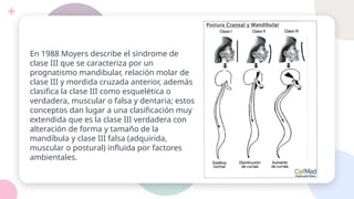 En 1988 Moyers describe el síndrome de
clase III que se caracteriza por un
prognatismo mandibular, relación molar de
clase III y mordida cruzada anterior, además
clasifica la clase III como esquelética o
verdadera, muscular o falsa y dentaria; estos
conceptos dan lugar a una clasificación muy
extendida que es la clase III verdadera con
alteración de forma y tamaño de la
mandíbula y clase III falsa (adquirida,
muscular o postural) influida por factores
ambientales.
 