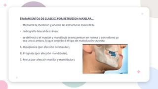 TRATAMIENTOS DE CLASE III POR RETRUSION MAXILAR…
- Mediante la medición y análisis las estructuras óseas de la
- radiografía lateral de cráneo:
- se definirá si el maxilar y mandíbula se encuentran en norma o con valores ya
sea uno o ambos, lo que describirá el tipo de maloclusión sea esta:
A) Hipoplásica (por afección del maxilar),
B) Prognata (por afección mandibular),
C) Mixta (por afección maxilar y mandibular).
 