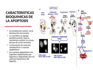 CARACTERISTICAS
BIOQUIMICAS DE
LA APOPTOSIS
• La tumefacción celular ,no la
disminución de tamaño
• La cromatina se agrega
periféricamente, bajo la
membrana nuclear, en masas
densas de varios tamaños
• La formación de vesículas
citoplásmicas y cuerpos
apoptósicos
• Los cuerpos apoptósicos son
ingeridos rápidamente por
fagocitos y degradados por las
enzimas lisosómicas del
fagocito.
 