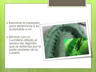    Examinar la impresión
    para determinar si es
    aceptable o no.

   Eliminar con un
    cuchillete afilado el
    exceso de alginato
    que se extienda por la
    parte posterior de la
    cubeta
 