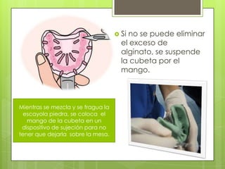  Sino se puede eliminar
                                      el exceso de
                                      alginato, se suspende
                                      la cubeta por el
                                      mango.



Mientras se mezcla y se fragua la
  escayola piedra, se coloca el
   mango de la cubeta en un
 dispositivo de sujeción para no
tener que dejarla sobre la mesa.
 