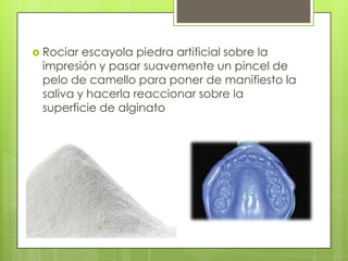  Rociar escayola piedra artificial sobre la
 impresión y pasar suavemente un pincel de
 pelo de camello para poner de manifiesto la
 saliva y hacerla reaccionar sobre la
 superficie de alginato
 