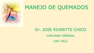MANEJO DE QUEMADOS
Dr. JOSE RIVERTTE CHICO
CIRUJANO GENERAL
UNT-2022
 