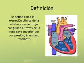 Definición
  Se define como la
 expresión clinica de la
  obstrucción del flujo
sanguineo a traves de la
 vena cava superior por
 compresión, invasión o
       trombosis
 