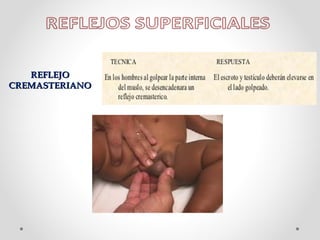 REFLEJO
CREMASTERIANO

 