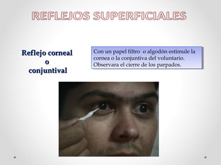 Reflejo corneal
o
conjuntival

Con un papel filtro o algodón estimule la
Con un papel filtro o algodón estimule la
cornea o la conjuntiva del voluntario.
cornea o la conjuntiva del voluntario.
Observara el cierre de los parpados.
Observara el cierre de los parpados.

 