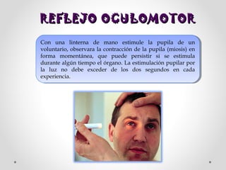REFLEJO OCULOMOTOR
Con una linterna de mano estimule la pupila de un
Con una linterna de mano estimule la pupila de un
voluntario, observara la contracción de la pupila (miosis) en
voluntario, observara la contracción de la pupila (miosis) en
forma momentánea, que puede persistir si se estimula
forma momentánea, que puede persistir si se estimula
durante algún tiempo el órgano. La estimulación pupilar por
durante algún tiempo el órgano. La estimulación pupilar por
la luz no debe exceder de los dos segundos en cada
la luz no debe exceder de los dos segundos en cada
experiencia.
experiencia.

 