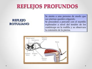 REFLEJO
ROTULIANO

Se sienta aa una persona de modo que
Se sienta una persona de modo que
sus piernas queden colgando.
sus piernas queden colgando.
Se procederá aa percutir con el martillo
Se procederá percutir con el martillo
explorador aa nivel del tendón de los
explorador
nivel del tendón de los
cuádriceps en la rodilla y se observara
cuádriceps en la rodilla y se observara
la extensión de la pierna.
la extensión de la pierna.

 