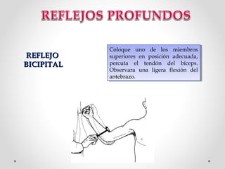 REFLEJO
BICIPITAL

Coloque uno de los miembros
Coloque uno de los miembros
superiores en posición adecuada,
superiores en posición adecuada,
percuta el tendón del bíceps.
percuta el tendón del bíceps.
Observara una ligera flexión del
Observara una ligera flexión del
antebrazo.
antebrazo.

 