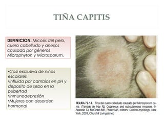 Sebo Capities Enfermedades Infecciosas de Piel | PPT
