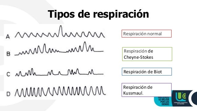 Biot Respirations Are Characterized By