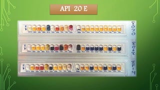 API 20 E 
 