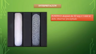 INTERPRETACION 
POSITIVO: después de 30 seg o 1 min se 
debe observar precipitado 
 