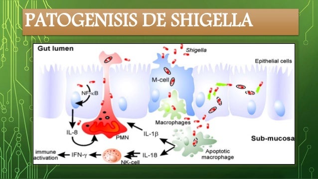 Shigella dysenteriae
