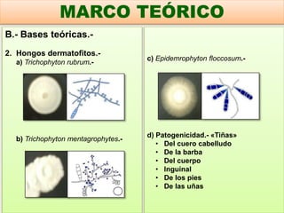 B.- Bases teóricas.-
2. Hongos dermatofitos.-
a) Trichophyton rubrum.-
b) Trichophyton mentagrophytes.-
MARCO TEÓRICO
c) Epidemrophyton floccosum.-
d) Patogenicidad.- «Tiñas»
• Del cuero cabelludo
• De la barba
• Del cuerpo
• Inguinal
• De los pies
• De las uñas
 