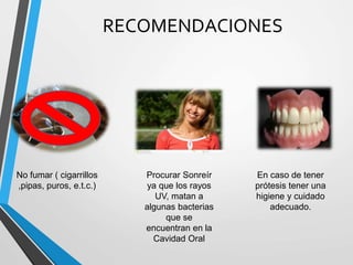 RECOMENDACIONES
No fumar ( cigarrillos
,pipas, puros, e.t.c.)
Procurar Sonreír
ya que los rayos
UV, matan a
algunas bacterias
que se
encuentran en la
Cavidad Oral
En caso de tener
prótesis tener una
higiene y cuidado
adecuado.
 