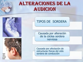 ALTERACIONES DE LA AUDICION