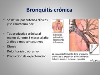 Bronquitis crónica
• Se define por criterios clínicos
y se caracteriza por:
• Tos productiva crónica al
menos durante 3 meses al año,
2 años o mas consecutivos
• Disnea
• Dolor torácico opresivo
• Producción de expectoración
 