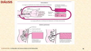 DIÁLISIS
EXPOSITOR: YOMAIRA SUSANA HOLGUIN ROSADO 42
 