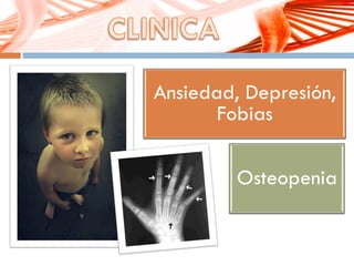 Ansiedad, Depresión,
Fobias
Osteopenia
 