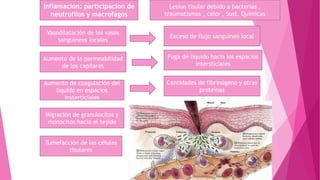 Vasodilatación de los vasos
sanguíneos locales
Migración de granulocitos y
monocitos hacia el tejido
Exceso de flujo sanguíneo local
Lesion tisular debido a bacterias ,
traumatismos , calor , Sust. Químicas
Fuga de liquido hacia los espacios
intersticiales
Tumefacción de las células
tisulares
Aumento de la permeabilidad
de los capilares
Cantidades de fibrinógeno y otras
proteínas
Aumento de coagulación del
liquido en espacios
insterticiales
Inflamacion: participacion de
neutrofilos y macrofagos
 