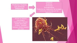 Productos tisulares
que provocan
inflamación
Histamina
Bradicina
Serotonina
Prostaglandinas
Productos de coagulación de la sangre
Linfocinas producidas por los
linfocitos T
Activan el sistema
macrofagico
Comienzan a devorar
tejidos destruidos
A veces , también
lesionan células tisulares
aun vivas
 