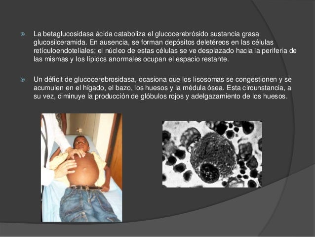 Como adelgazar a 25 kg en un mes en las condiciones de casa las revocaciones