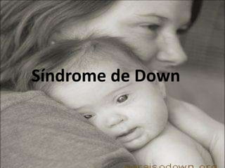 Síndrome de Down
 