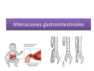 Alteraciones gastrointestinales
 
