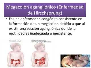 Megacolon agangliónico (Enfermedad
        de Hirschsprung)
• Es una enfermedad congénita consistente en
  la formación de un megacolon debido a que al
  existir una sección agangliónica donde la
  motilidad es inadecuada o inexistente.
 