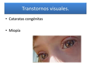 Transtornos visuales.
• Cataratas congénitas

• Miopía
 
