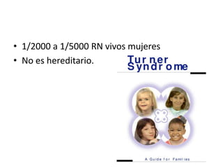 • 1/2000 a 1/5000 RN vivos mujeres
• No es hereditario.
 