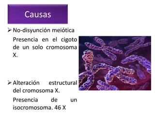 Causas
 No-disyunción meiótica
  Presencia en el cigoto
  de un solo cromosoma
  X.



 Alteración estructural
  del cromosoma X.
  Presencia   de     un
  isocromosoma. 46 X
 