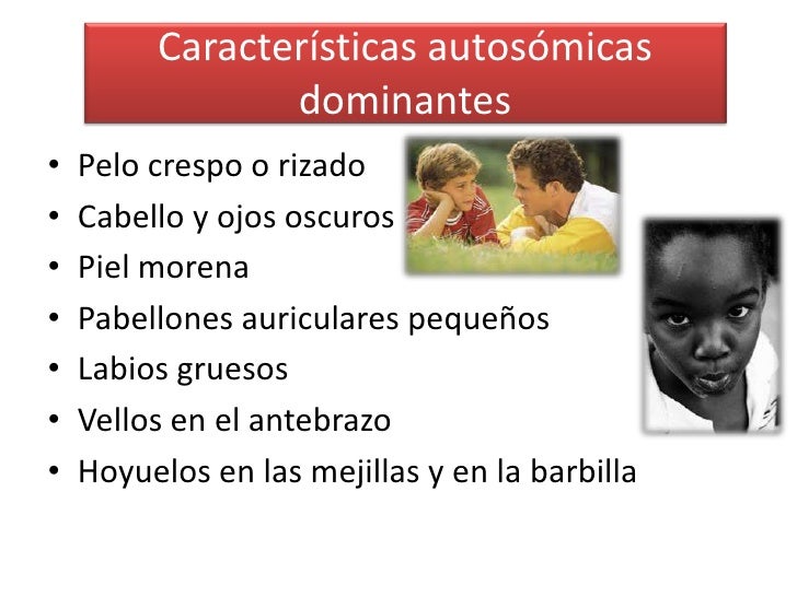 Genetica sindrome de down Genetica sindrome de down