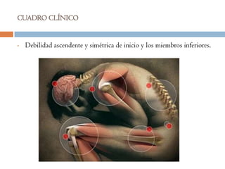 CUADRO CLÍNICO


•   Debilidad ascendente y simétrica de inicio y los miembros inferiores.
 