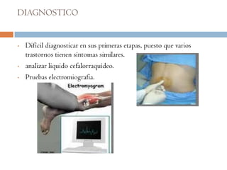 DIAGNOSTICO


•   Difícil diagnosticar en sus primeras etapas, puesto que varios
    trastornos tienen síntomas similares.
•   analizar liquido cefalorraquídeo.
•   Pruebas electromiografia.
 