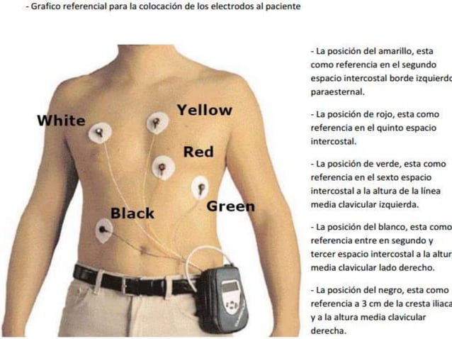 Holter cardiaco y cuidados de enfermeria