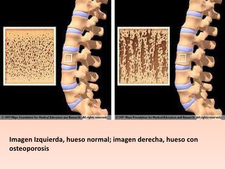 Los dolores en los riñones que da en la articulación coxal