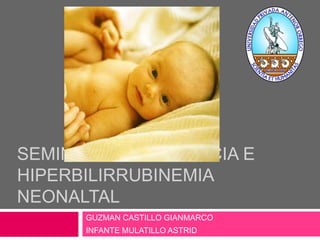 SEMINARIO DE ICTERICIA E 
HIPERBILIRRUBINEMIA 
NEONALTAL 
GUZMAN CASTILLO GIANMARCO 
INFANTE MULATILLO ASTRID 
 